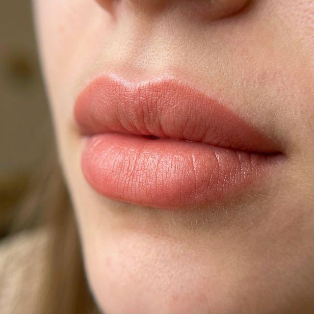 Candy Lips : avant / après, à quoi s'attendre