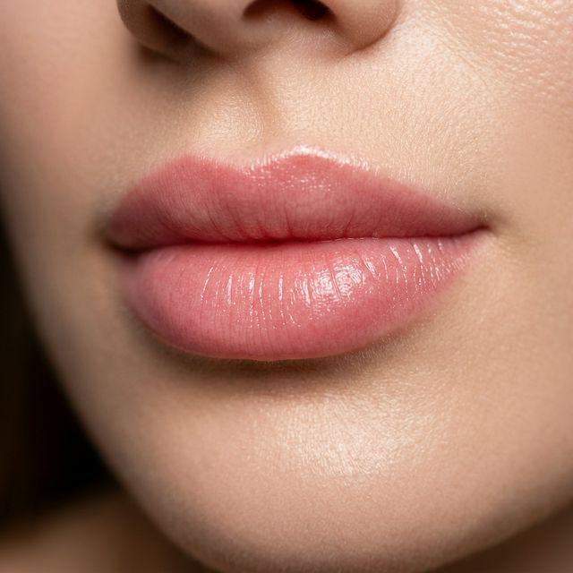 Candy Lips à Bougival : la bouche rosée et repulpée naturellement