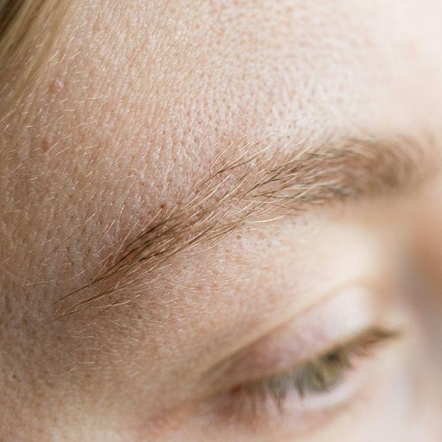 Mes sourcils n'ont pas tenu : les causes possibles